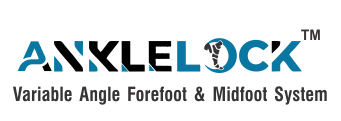 ANKLELOCK.png