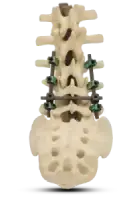 spine